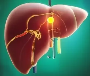 craiyon_193515_Create_an_image_about_heat_in_Liver_from_tradicional_chinese_medicine_With_a_green_ba