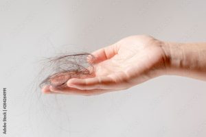 tratament natural impotriva caderii parului